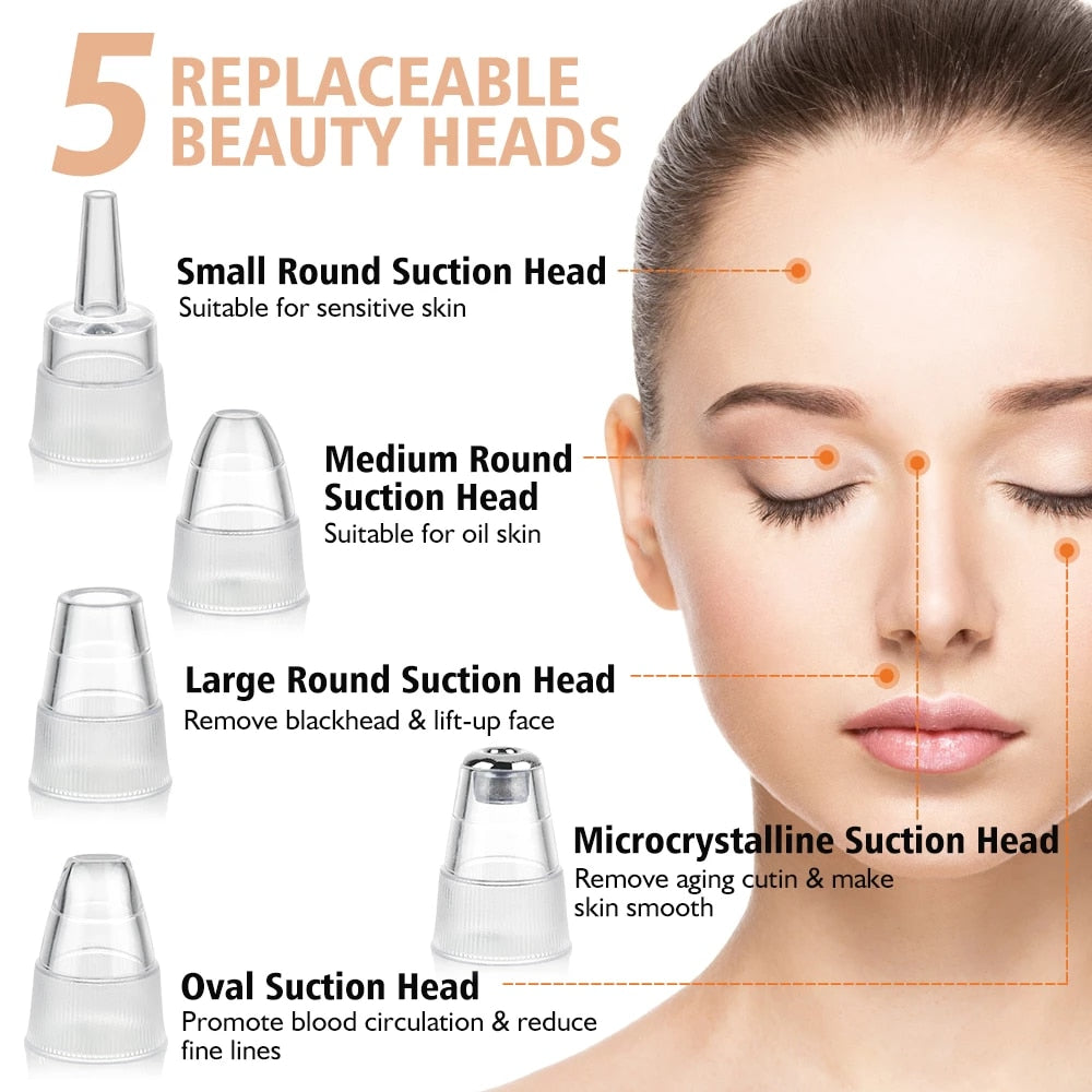 Face Vac™ - Blackhead and Acne Remover