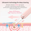 Load image into Gallery viewer, ALN™ - Ultrasonic Skin Scrubber and Tightener